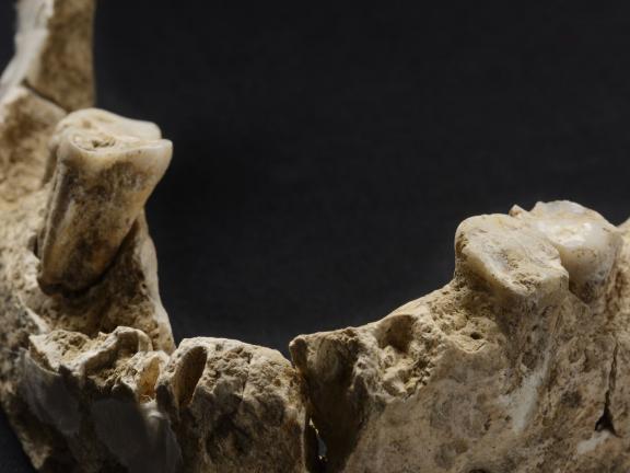 mandibule